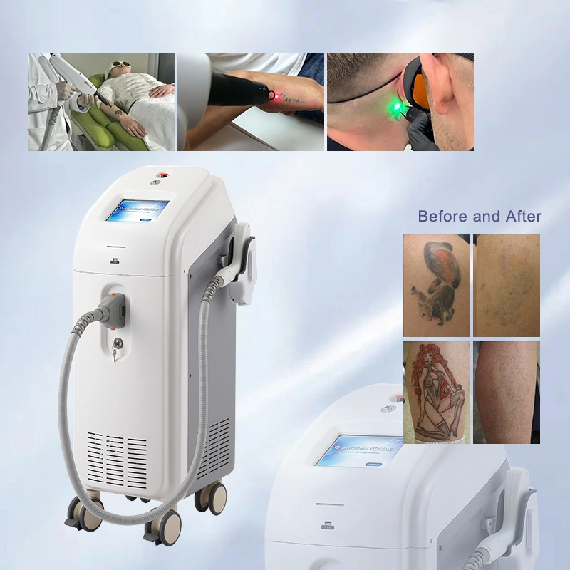 Spectra ND YAG Laser Q-Switch ND YAG Laser Aesthetic Machine for Tattoo Removal and Pigmentation Removal